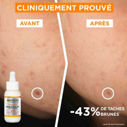 GARNIER VITAMINE C Sérum Éclat Anti-taches 30ml